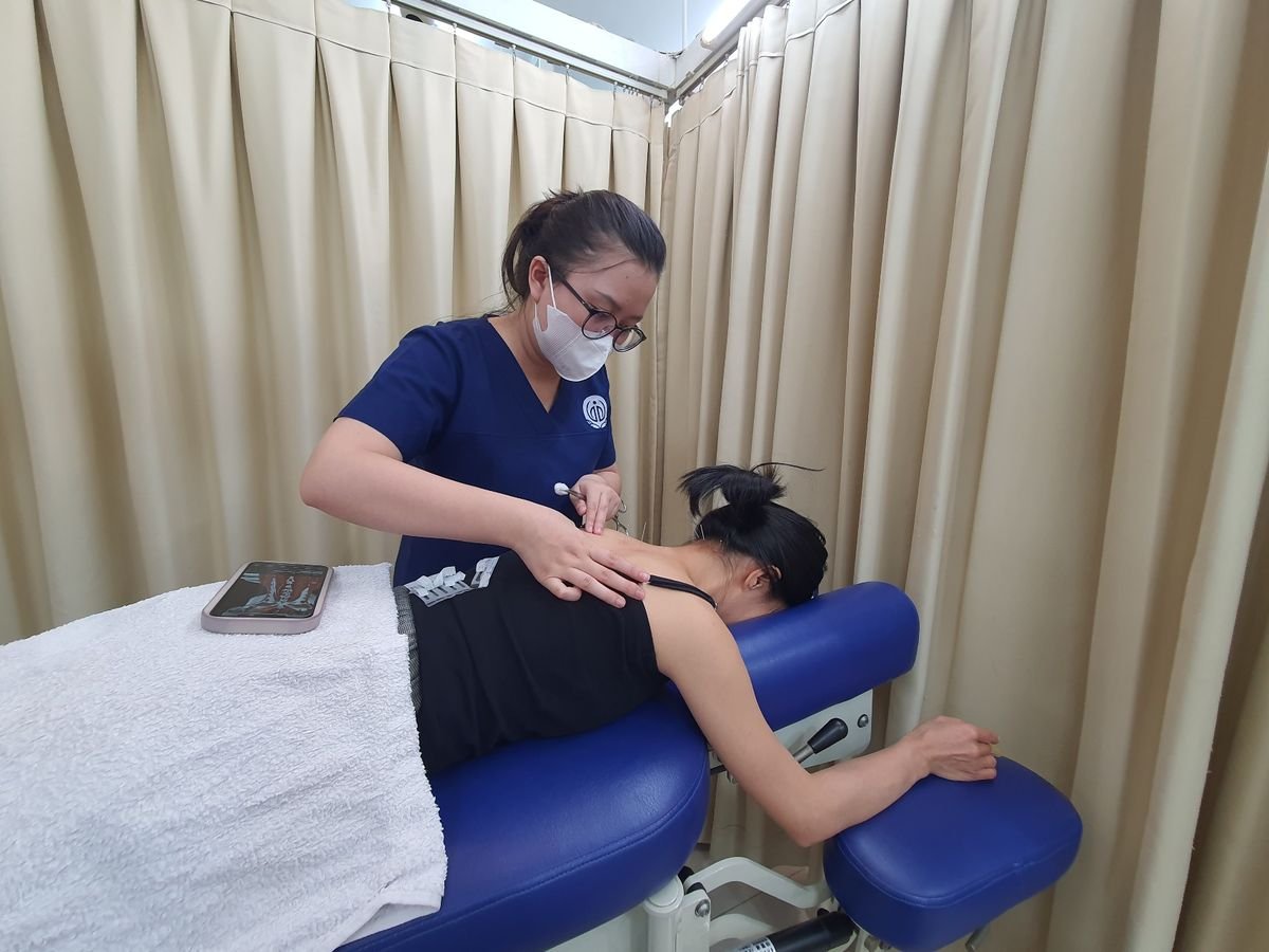 Châm cứu vùng vai lưng tại phòng khám Đông y Tâm Đức