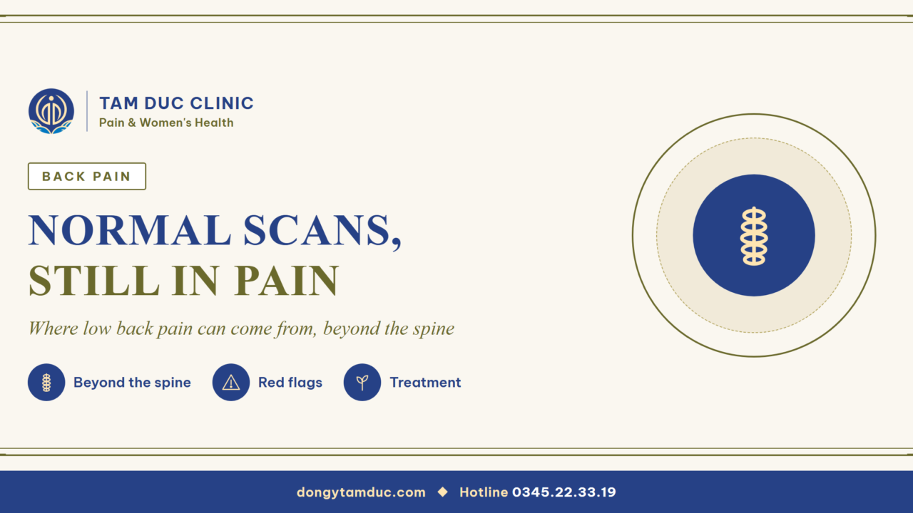 Back pain with normal scans: the source may not be in the spine