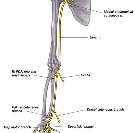 CHÈN ÉP THẦN KINH TRỤ