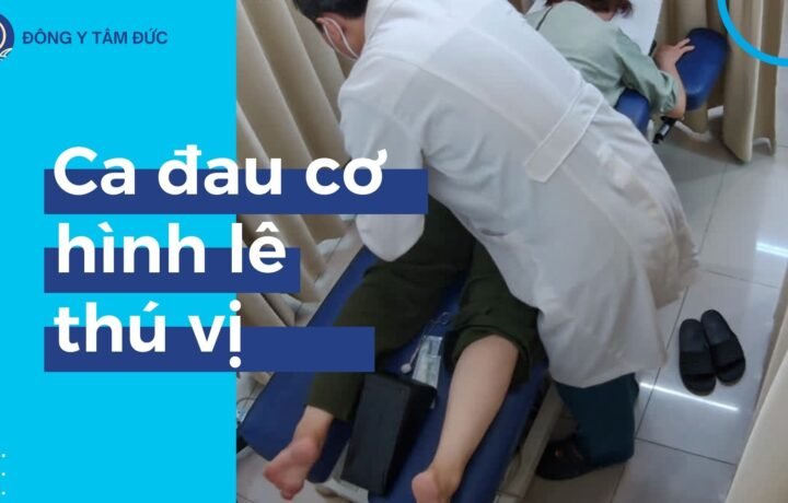 Một ca đau cơ hình lê thú vị