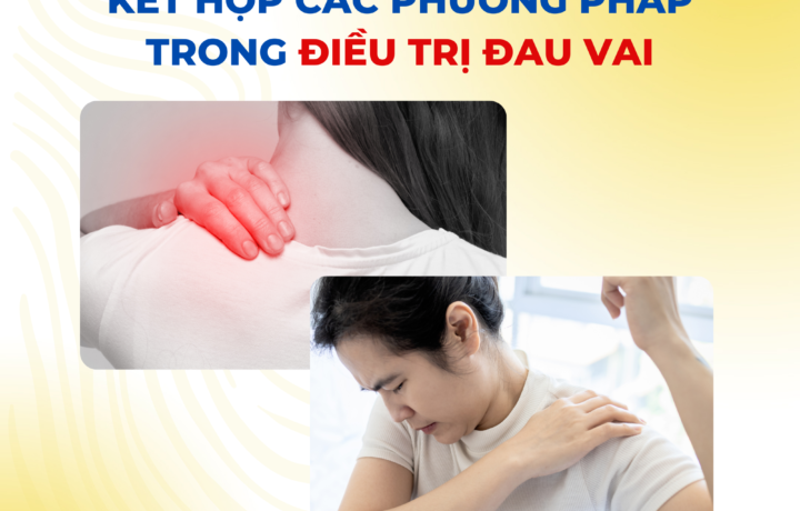 Kết hợp các phương pháp trong điều trị Đau vai