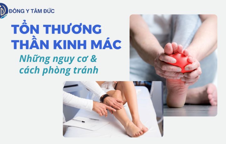 Phòng tránh tổn thương thần kinh mác