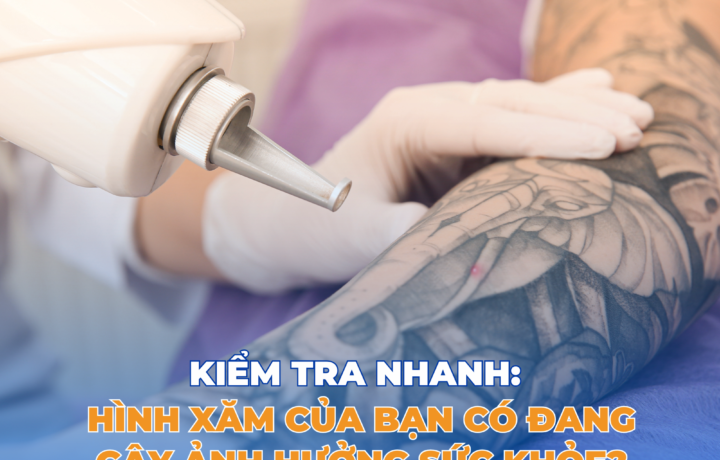 Hình xăm nghệ thuật – khi dấu ấn đẹp để lại rối loạn thần kinh tiềm ẩn