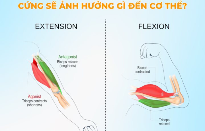 Hyper: Cơ bắp luôn trong trạng thái co cứng – thực trạng của nhiều bệnh lý đau nhức