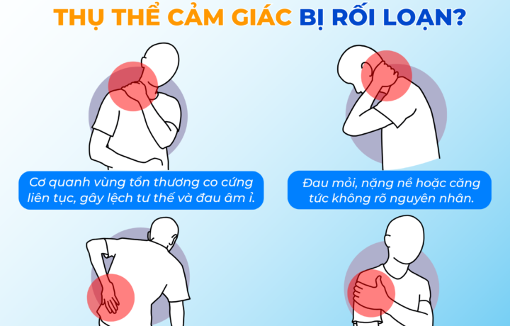 Thụ thể cảm giác – liên quan đến những cơn đau lưng, cổ dai dẳng