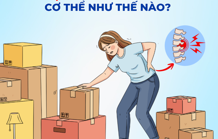 Vác túi một bên vai, ngồi lệch – Lệch trục cột sống và đau lưng, hông